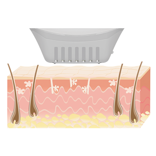 SalonPro System IPL hair removal, Beurer