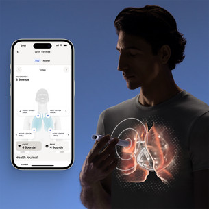 BeamO, valge/must - 4-ühes tervisenäitajate monitor